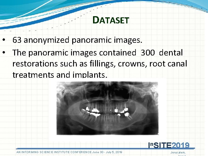 DATASET • 63 anonymized panoramic images. • The panoramic images contained 300 dental restorations