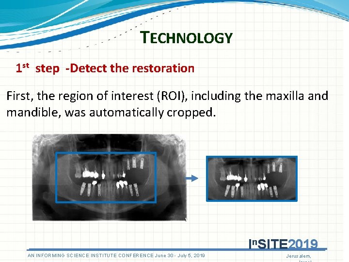 TECHNOLOGY 1 st step -Detect the restoration First, the region of interest (ROI), including