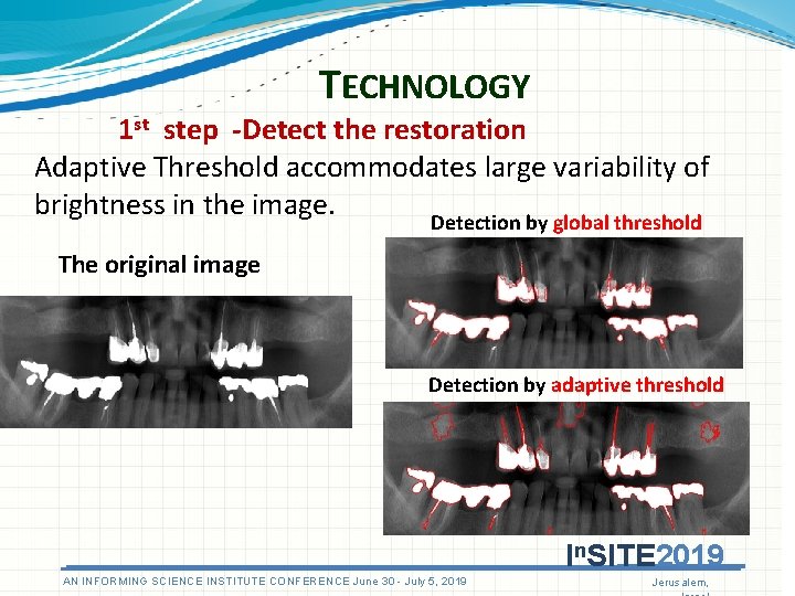 TECHNOLOGY 1 st step -Detect the restoration Adaptive Threshold accommodates large variability of brightness