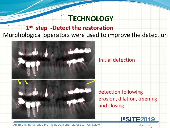 TECHNOLOGY 1 st step -Detect the restoration Morphological operators were used to improve the