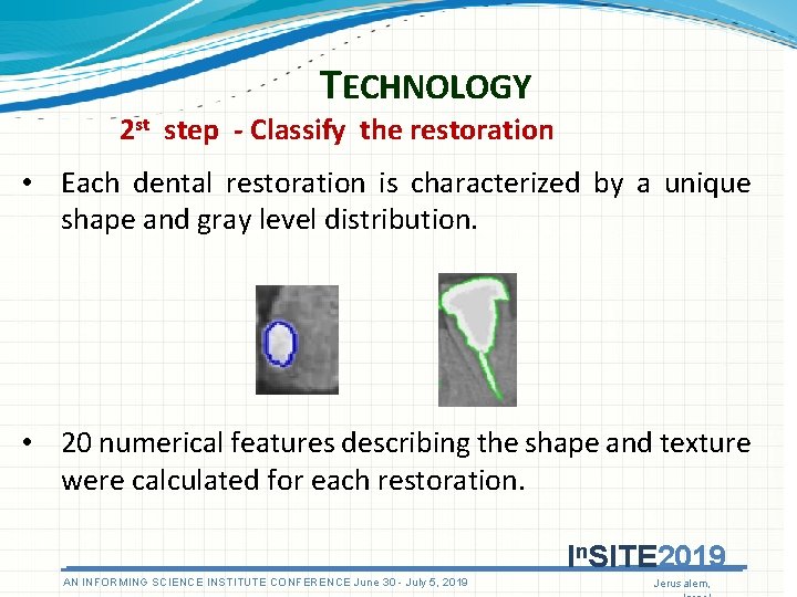 TECHNOLOGY 2 st step - Classify the restoration • Each dental restoration is characterized