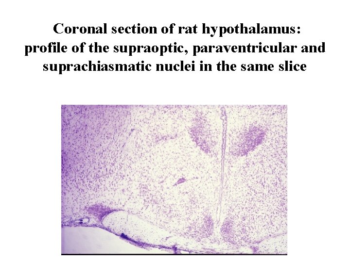 Coronal section of rat hypothalamus: profile of the supraoptic, paraventricular and suprachiasmatic nuclei in