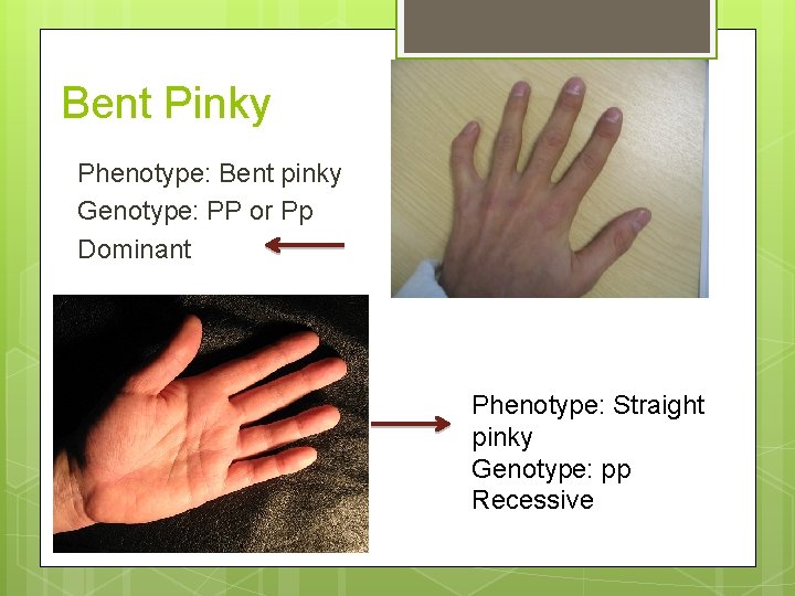 Bent Pinky Phenotype: Bent pinky Genotype: PP or Pp Dominant Phenotype: Straight pinky Genotype: