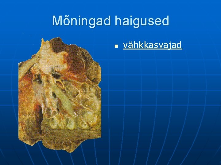 Mõningad haigused n vähkkasvajad 