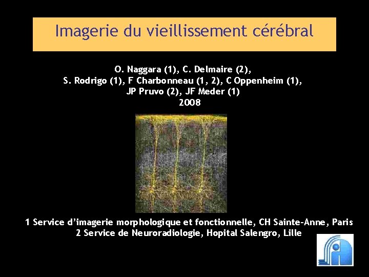 Imagerie du vieillissement cérébral O. Naggara (1), C. Delmaire (2), S. Rodrigo (1), F