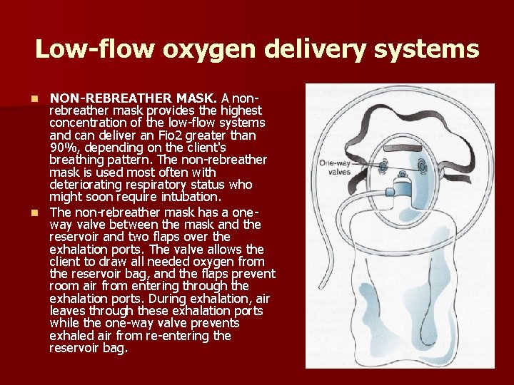 Low-flow oxygen delivery systems NON-REBREATHER MASK. A nonrebreather mask provides the highest concentration of