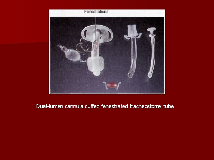 Dual-lumen cannula cuffed fenestrated tracheostomy tube 