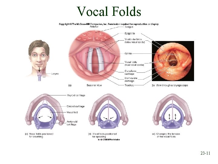 Vocal Folds 23 -11 