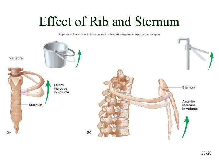 Effect of Rib and Sternum 23 -20 