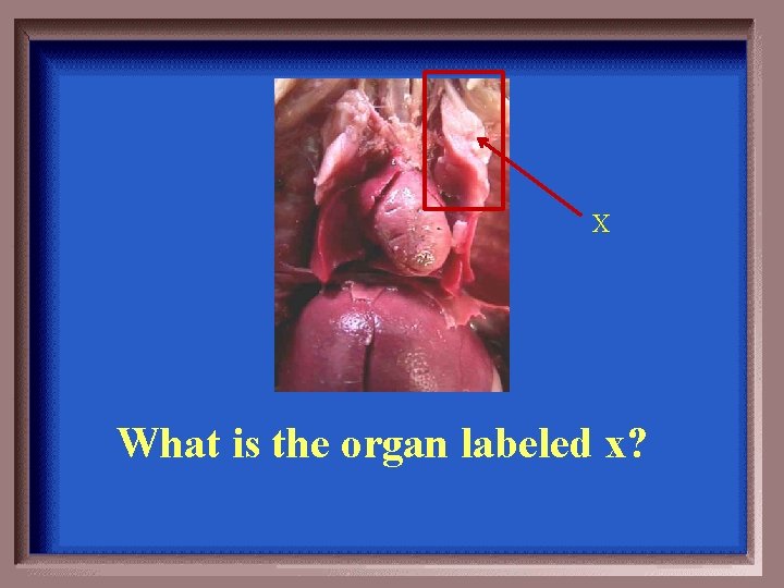 X What is the organ labeled x? 