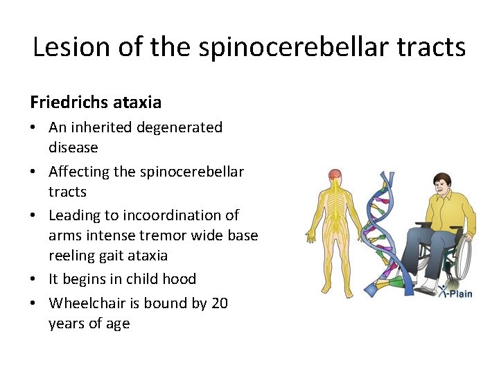 Lesion of the spinocerebellar tracts Friedrichs ataxia • An inherited degenerated disease • Affecting
