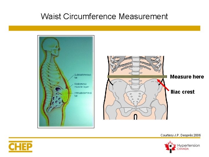 Waist Circumference Measurement Measure here Iliac crest Courtesy J. P. Després 2006 