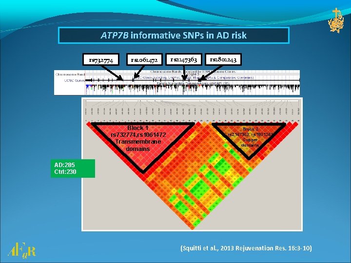 ATP 7 B informative SNPs in AD risk rs 732774 rs 1061472 Block 1