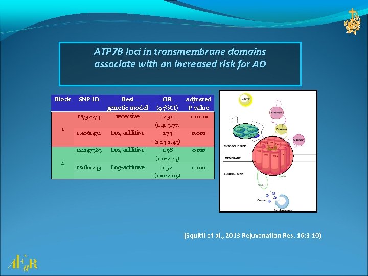 ATP 7 B loci in transmembrane domains associate with an increased risk for AD