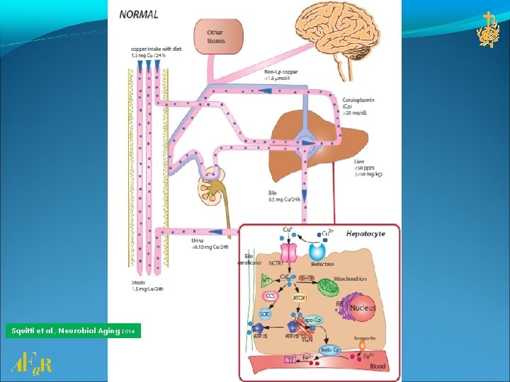 Squitti et al. , Neurobiol Aging 2014 