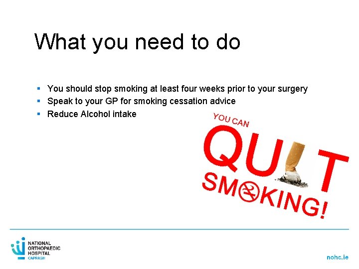 What you need to do § You should stop smoking at least four weeks