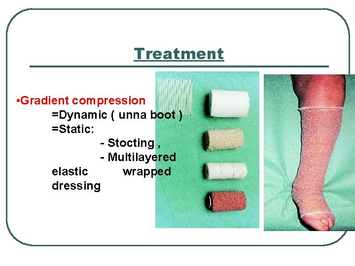 Treatment • Gradient compression =Dynamic ( unna boot ) =Static: - Stocting , -