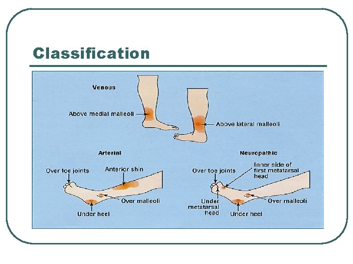 Classification 