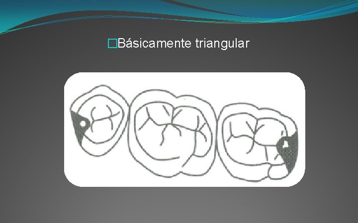 �Básicamente triangular 