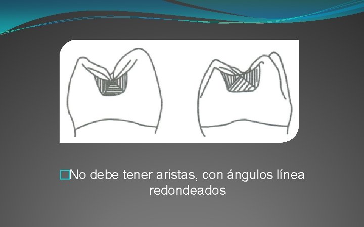 �No debe tener aristas, con ángulos línea redondeados 