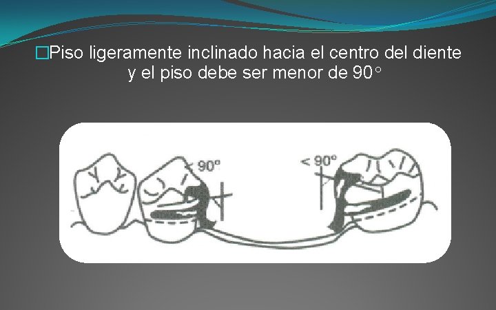 �Piso ligeramente inclinado hacia el centro del diente y el piso debe ser menor