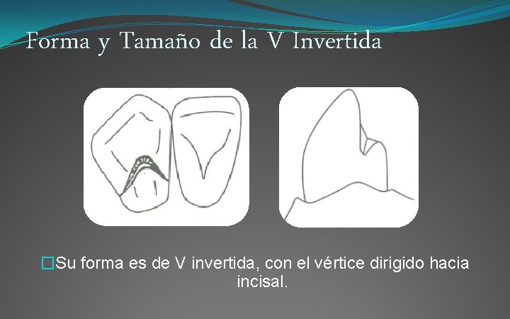 Forma y Tamaño de la V Invertida �Su forma es de V invertida, con