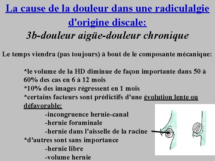 La cause de la douleur dans une radiculalgie d'origine discale: 3 b-douleur aigüe-douleur chronique