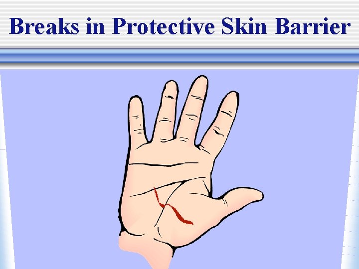 Breaks in Protective Skin Barrier 