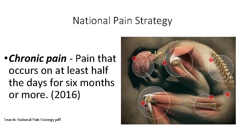 National Pain Strategy • Chronic pain ‐ Pain that occurs on at least half National Pain Strategy • Chronic pain ‐ Pain that occurs on at least half