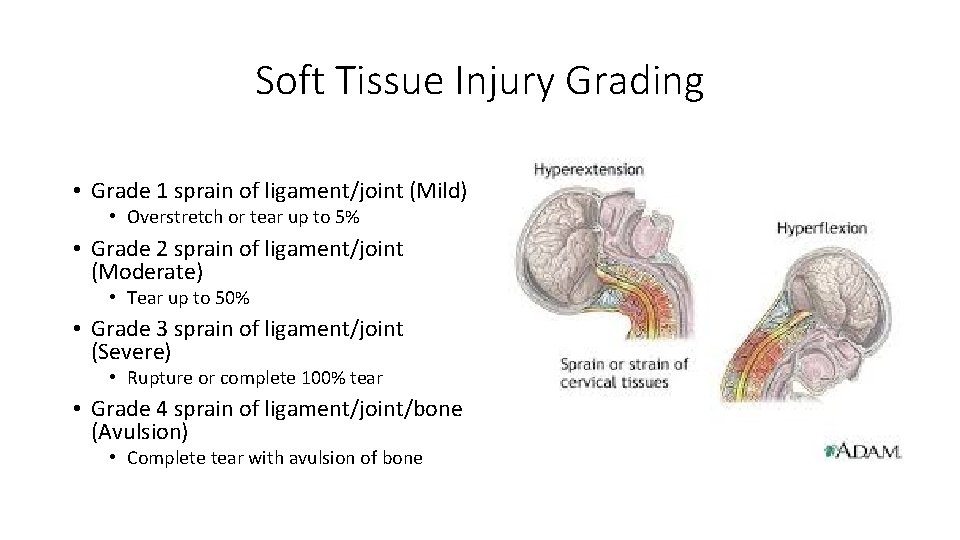 Soft Tissue Injury Grading • Grade 1 sprain of ligament/joint (Mild) • Overstretch or Soft Tissue Injury Grading • Grade 1 sprain of ligament/joint (Mild) • Overstretch or