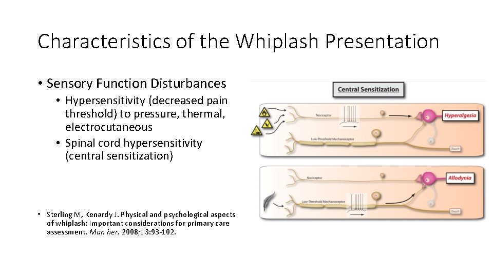 Characteristics of the Whiplash Presentation • Sensory Function Disturbances • Hypersensitivity (decreased pain threshold) Characteristics of the Whiplash Presentation • Sensory Function Disturbances • Hypersensitivity (decreased pain threshold)