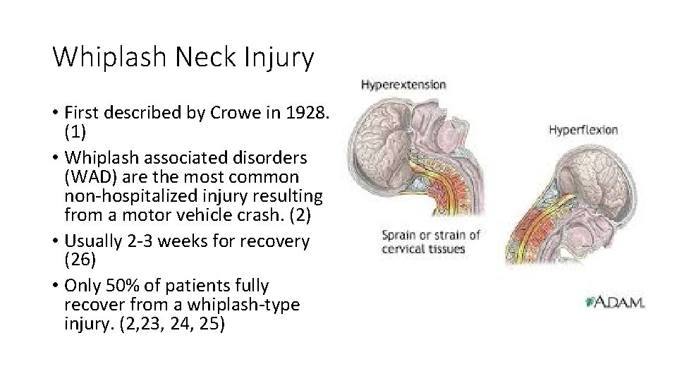 Whiplash Neck Injury • First described by Crowe in 1928. (1) • Whiplash associated Whiplash Neck Injury • First described by Crowe in 1928. (1) • Whiplash associated