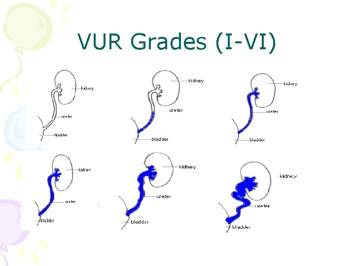 VUR Grades (I-VI) 