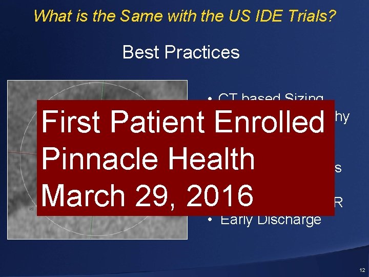 What is the Same with the US IDE Trials? Best Practices • CT based