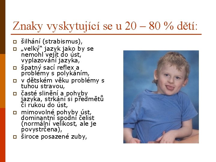 Znaky vyskytující se u 20 – 80 % dětí: p p p p šilhání