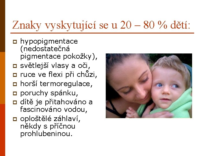 Znaky vyskytující se u 20 – 80 % dětí: p p p p hypopigmentace