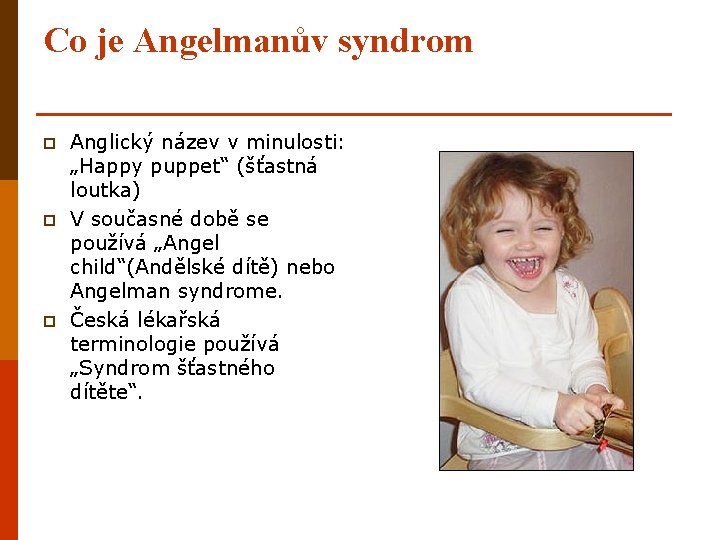 Co je Angelmanův syndrom p p p Anglický název v minulosti: „Happy puppet“ (šťastná