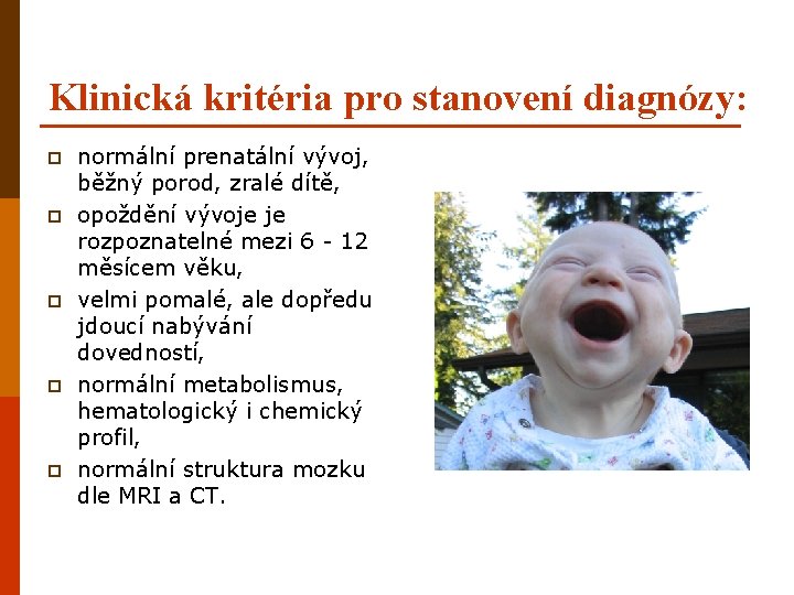 Klinická kritéria pro stanovení diagnózy: p p p normální prenatální vývoj, běžný porod, zralé