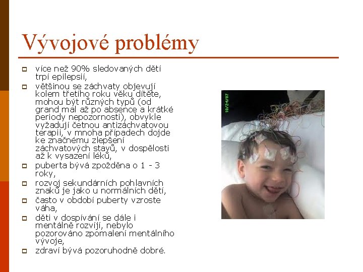 Vývojové problémy p p p p více než 90% sledovaných dětí trpí epilepsií, většinou