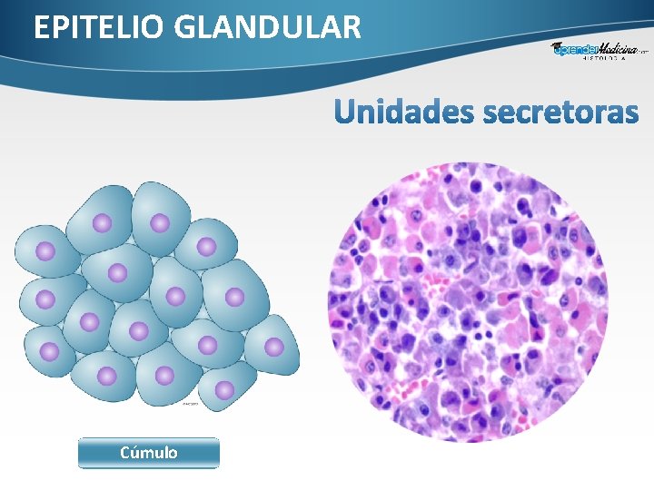 EPITELIO GLANDULAR Cúmulo 