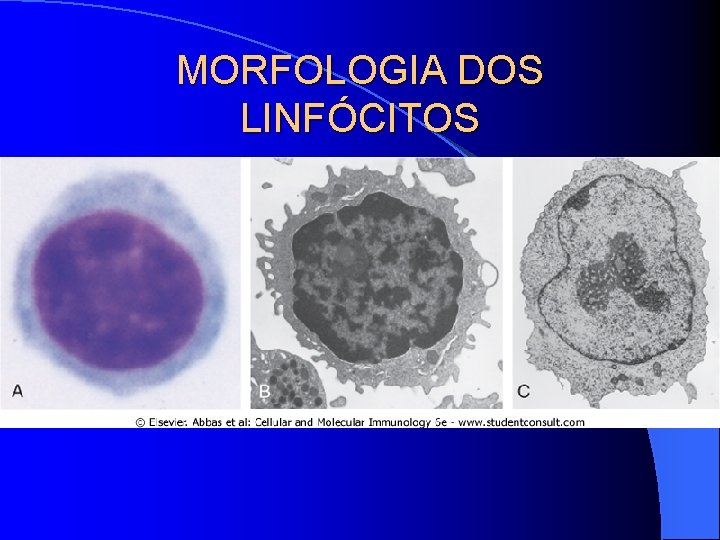 MORFOLOGIA DOS LINFÓCITOS 