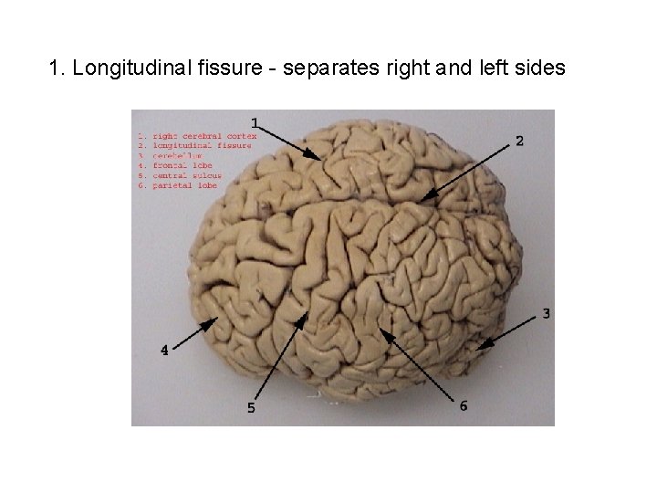  1. Longitudinal fissure - separates right and left sides 