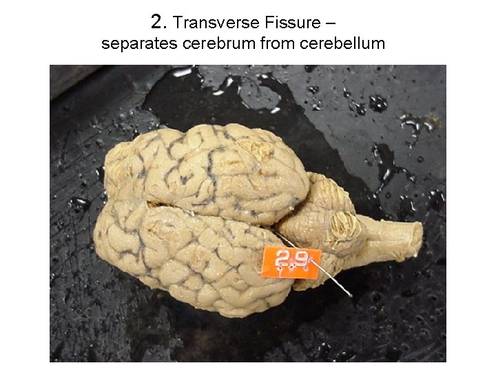 2. Transverse Fissure – separates cerebrum from cerebellum 