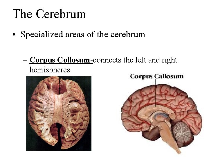 The Cerebrum • Specialized areas of the cerebrum – Corpus Collosum-connects the left and