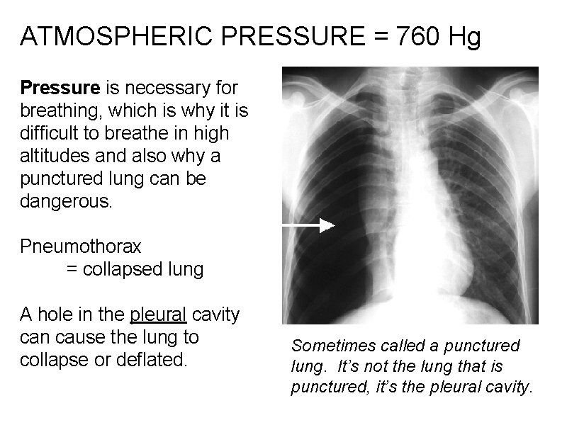 ATMOSPHERIC PRESSURE = 760 Hg Pressure is necessary for breathing, which is why it