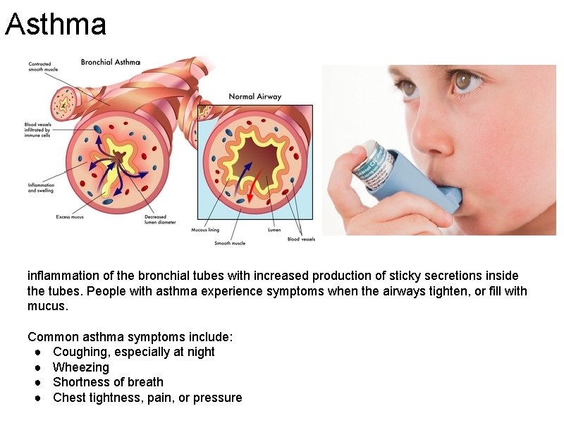 Asthma inflammation of the bronchial tubes with increased production of sticky secretions inside the
