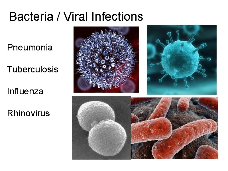 Bacteria / Viral Infections Pneumonia Tuberculosis Influenza Rhinovirus 