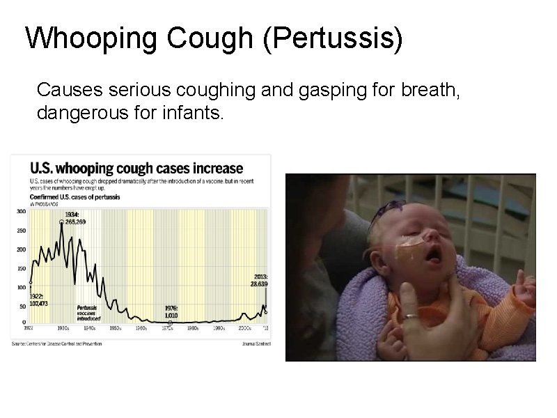 Whooping Cough (Pertussis) Causes serious coughing and gasping for breath, dangerous for infants. 