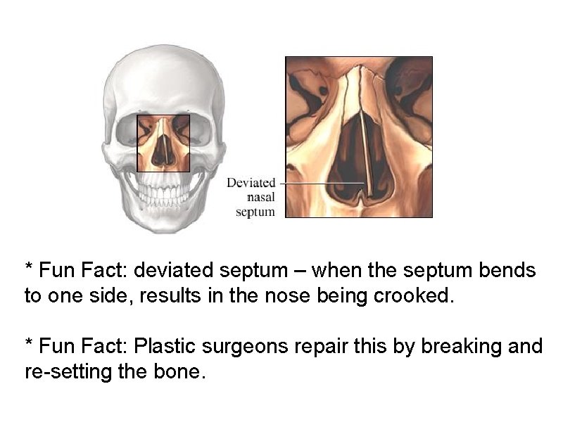 * Fun Fact: deviated septum – when the septum bends to one side, results