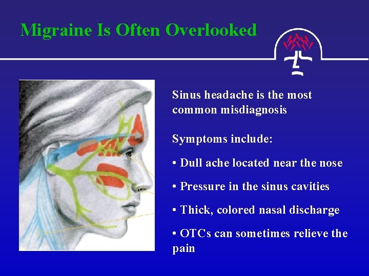 Migraine Is Often Overlooked Sinus headache is the most common misdiagnosis Symptoms include: •